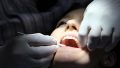 Diş Çekimi Hangi Durumlarda Yapılır?