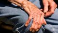 Parkinson Hastalığı: Nedenleri, Semptomları, Teşhis ve Tedavisi
